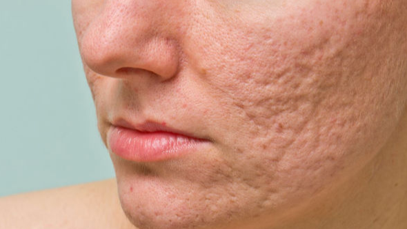 Kozmeker Skin Studio